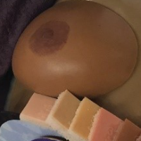 Custom breast prosthesis