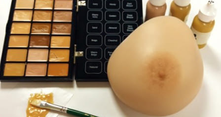 breast prosthesis img